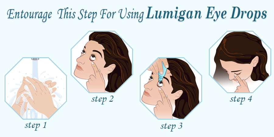 How to Use Lumigan Eye Drops?